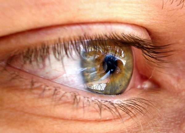 Eye 