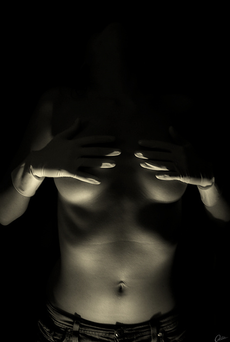 **Хирургам посвящается** Хирургам посвящается ню Bianca by ГЕЛЛА