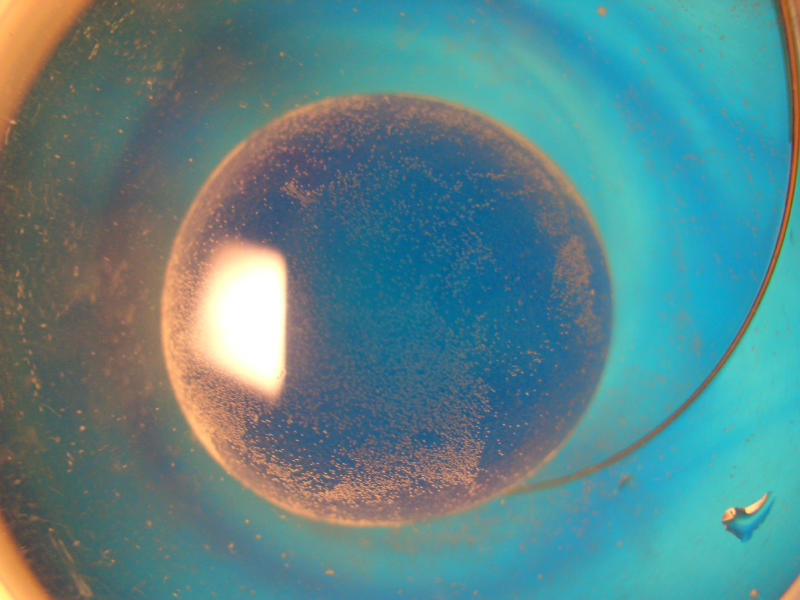 galaxy inoculation 