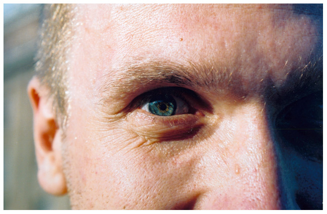 eye 