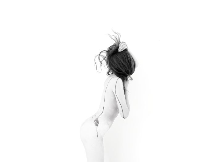 Vitiligo 
