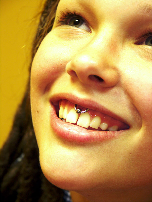 Smile-piercing пирсинг, улыбка