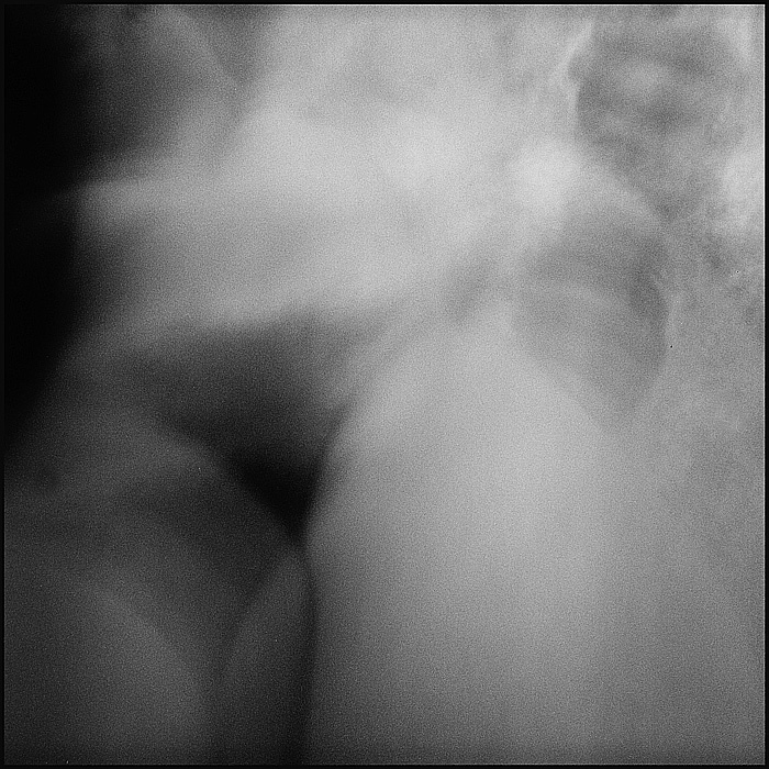 *** 