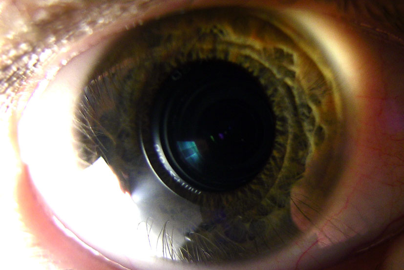 Green 24mm 