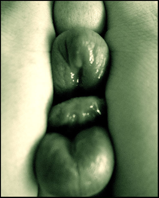 -IN- 