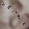 vectors