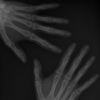 iogann86